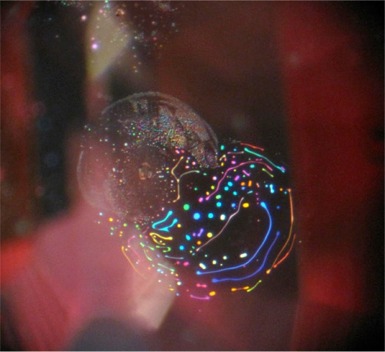 Inclusion in the sapphire